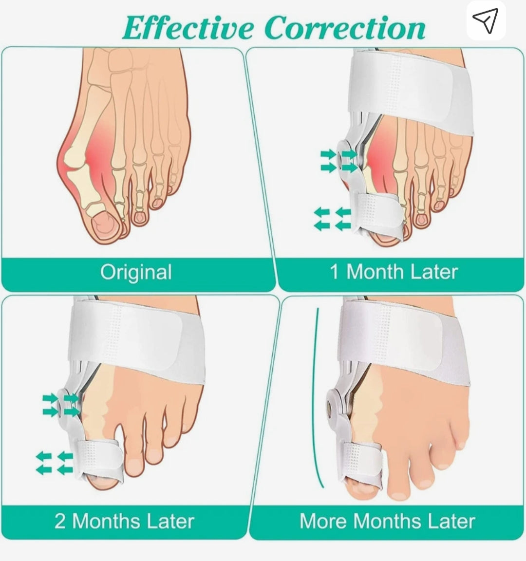 Silicone Toe Separator For Adults Bunion Corrector Splint Kit For Toe