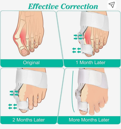 Silicone Toe Separator For Adults Bunion Corrector Splint Kit For Toe
